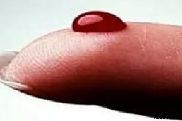 Активация системы свертывания